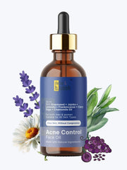 Acne Control Face Oil - Dazze and blussh